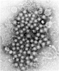 Hepatitis image