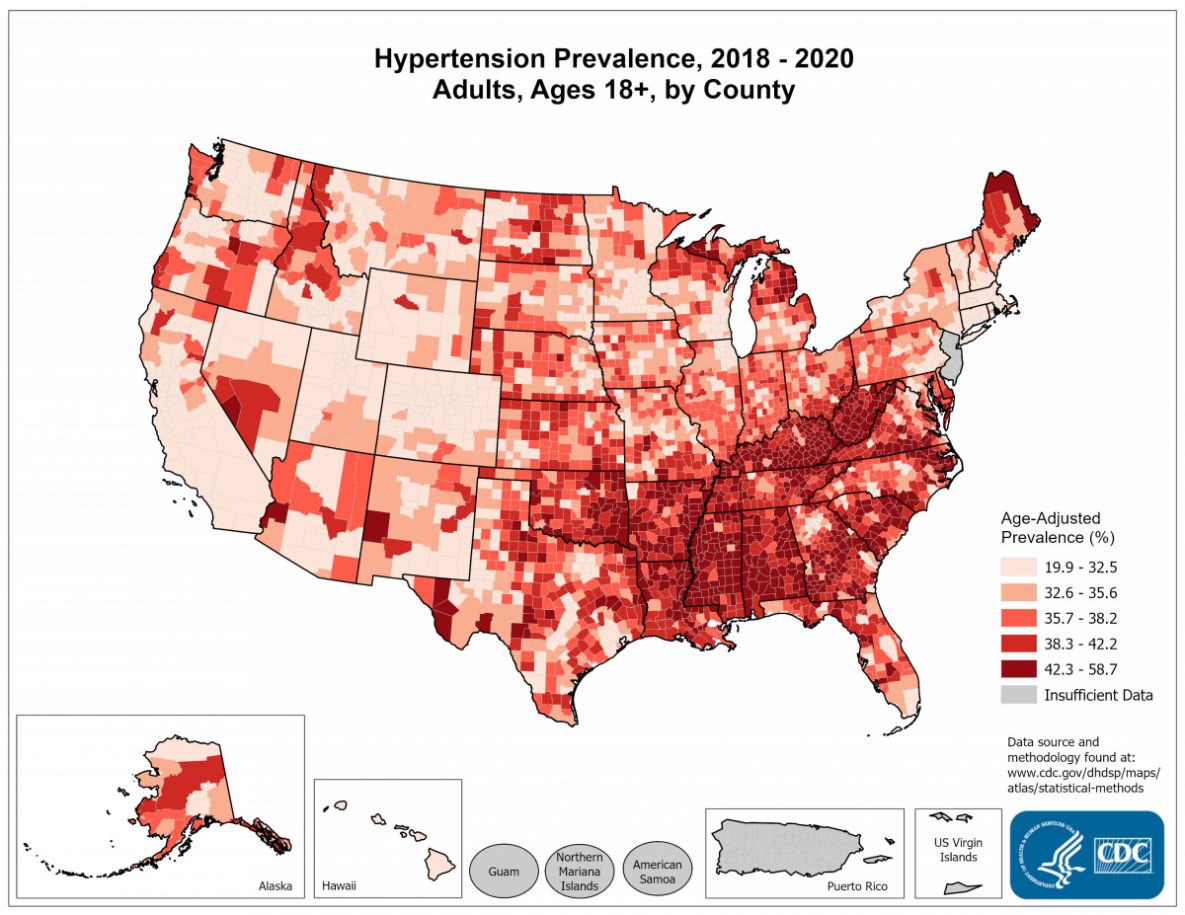 Hypertension Prevalence for 2018 through 2020 for Adults Aged 28 Years and Older by County. The map shows that concentrations of counties with the highest hypertension prevalence - meaning the top quintile - are located primarily in Mississippi, Louisiana, Arkansas, Oklahoma, Texas, Kentucky, Tennessee, Alabama, Georgia, South Carolina, North Carolina, Virginia, Maine, and Michigan. Pockets of high-rate counties also were found in Florida, New Mexico, Arizona, Nevada, and Missouri.