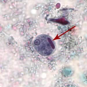 Figure A: Cyst of <em>E. histolytica/E. dispar</em> stained with trichrome. Note the chromatoid body with blunt ends (red arrow).