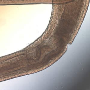 Figure E: Mid-section of a <em>Pseudoterranova</em> sp. worm, showing the esophagus and intestine. Image taken at 40x magnification.