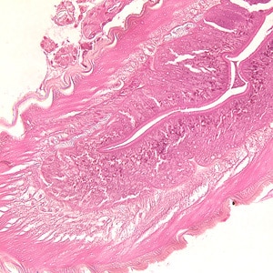 Figure B: Higher magnification (200x) of the specimen in Figure A, showing a close-up of the thick, multi-layered cuticle and tall, prominent muscle cells.