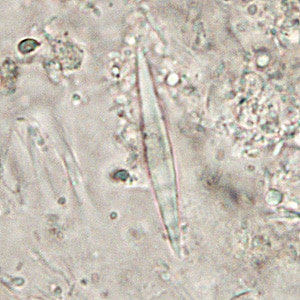 Figure D: Charcot-Leyden crystals. These crystals are the breakdown products of eosinophils and maybe found in the feces and sputum of people with tissue-invading parasitic infections or various allergic reactions.