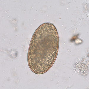 Figure E: Infertile, decorticated egg of <em>Ascaris lumbricoides</em>. Image courtesy of The Leiden University Medical Center, The Netherlands.