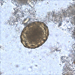 Figure D: Fertilized egg of <em>A. lumbricoides</em> in an unstained wet mount of stool.