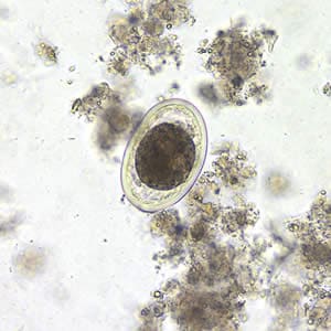 Figure B: <em>A. lumbricoides</em> decorticated, fertile egg in wet mounts, 200x magnification.