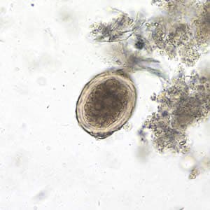 Figure C: <em>A. lumbricoides</em> decorticated, fertile egg in a wet mount, 200x magnification. The embryo has advanced cleavage.
