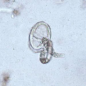 Figure B: Larva of <em>A. lumbricoides</em> hatching from an egg.