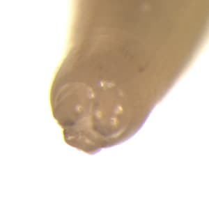 Figure C: Close-up of the anterior end of an adult <em>A. lumbricoides</em>. Note the three 'lips.' Image courtesy of the Orange County Public Health Laboratory, Santa Ana, CA.