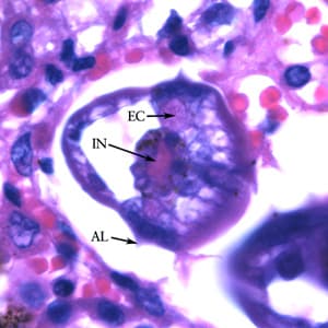 Figure B: Higher magnification (1000x) of the specimen in Figure A. Note the prominent alae (AL), intestine (IN) and excretory ducts (EC).