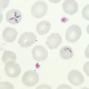 Figure C: <em>Babesia</em> sp. in a thin blood smear; note the tetrad form and ameboid trophozoite.