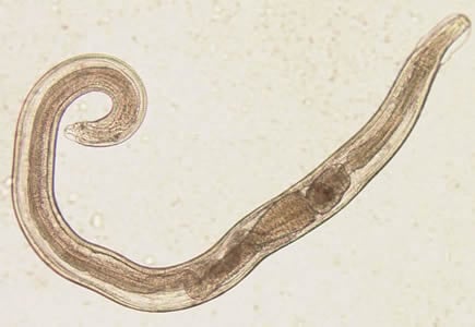Figure A: Adult male of <em>E. vermicularis</em> from a formalin-ethyl acetate (FEA) concentrated stool smear. The worm measured 1.4 mm in length. Image contributed by the Centre for Tropical Medicine and Imported Infectious Diseases, Bergen, Norway.