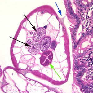 Figure B: Cross-section of an adult female <em>E. vermicularis</em> from the same specimen shown in Figure A. Note the presence of the alae (blue arrow), intestine (green arrow) and ovaries (black arrows). 