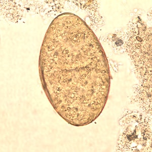 Figure B: Egg of <em>F. buski</em> in a unstained wet mount.