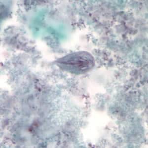 Figure A: <em>G. duodenalis</em> trophozoite stained with trichrome.