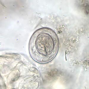 Figure B: Egg of <em>H. nana</em> in an unstained wet mount. Note the presence of hooks in the oncosphere and polar filaments within the space between the oncosphere and outer shell.