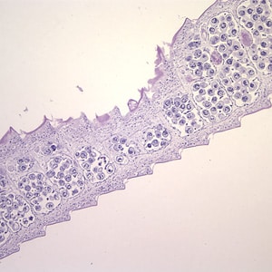 Figure A: Cross-sections of mature proglottids of <em>H. nana</em> stained with hematoxylin and eosin (H&E), taken at 100x. Note the craspedote (overlapping) proglottids.