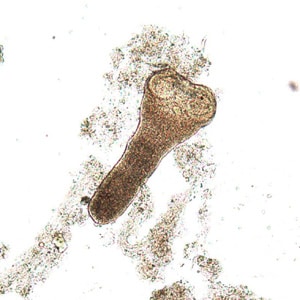 Figure B: Scolex of <em>H. nana</em> in an unstained wet mount of stool. Image courtesy of Dr. David Bruckner.