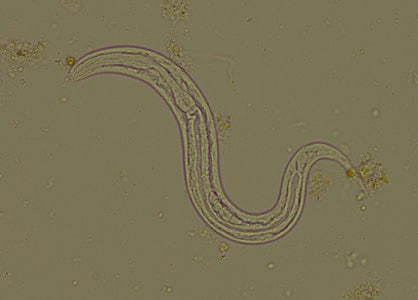 strongyloides stercoralis rhabditiform larvae
