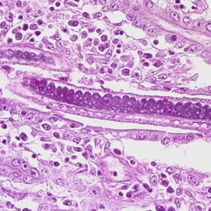 Figure D: Higher magnification of Figure C, showing stichocytes within the adult worm.