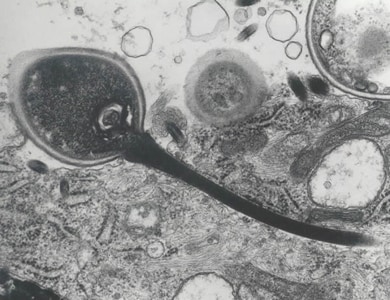 Figure F: Transmission electron micrograph of a microsporidian spore with an extruded polar tubule inserted into a eukaryotic cell. The spore injects the infective sporoplasms through its polar tubule. Figure courtesy of Dr. Massimo Scaglia, Laboratory of Clinical Parasitology, Institute of Infectious Diseases, University-IRCCS San Matteo, Pavia, Italy.
