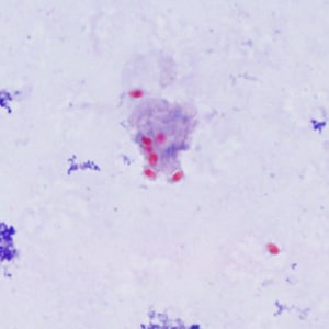 Figure A: Spores of <em>E. cuniculi</em> from urine stained with Ryan's modified trichrome (Trichrome blue).