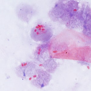 Figure B: Spores of <em>E. cuniculi</em> from urine stained with Ryan's modified trichrome (Trichrome blue).