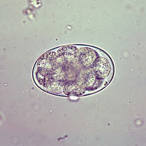 Figure A: Egg of <em>Oesophagostomum</em> sp. in an unstained wet mount of stool.