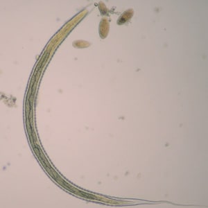 Figure A: L3 larva of <em>Oesophagostomum</em> sp., obtained via coproculture from the feces of a baboon (Papio ursinus) in South Africa. Note the long, thin, pointed tail. Image courtesy of the UTC Baboon Research Unit, University of Cape Town, South Africa.