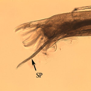 Figure E: Posterior end of male Oesophagostomum sp. Note the spicule (SP).