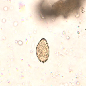 Figure A: Egg of <em>O. viverrini</em> in an unstained wet mount of concentrated stool. Image taken at 400x magnification.