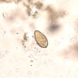 Figure D: Egg of <em>O. viverrini</em> in an unstained wet mount of concentrated stool. Image taken at 400x magnification.