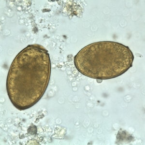 Figure C: Eggs of <em>P. westermani</em> in an unstained wet mount.
