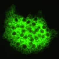 Figure B: Direct immunofluorescence antibody stain using monoclonal antibodies that target <em>Pneumocystis jirovecii</em>. This image is from a bronchoalveolar lavage (BAL) specimen from a patient with a malignancy. Image courtesy of Brigham & Women's Hospital, Boston, MA.