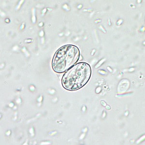 Figure D: Sporulated oocyst of <em>Sarcocystis</em> sp. in unstained wet mounts, magnification 400x.