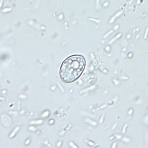 Figure B: Individual sporocyst of <em>Sarcocystis</em> sp. in an unstained wet mount, magnification 400x.