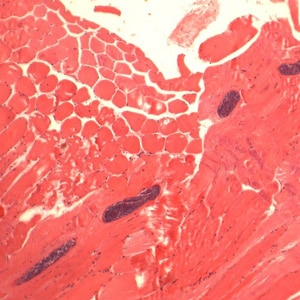 Figure C: Sarcocysts of <em>Sarcocystis</em> sp. in muscle tissue, stained with H&E. Image courtesy of the William Beaumont Hospital, Royal Oak, MI.