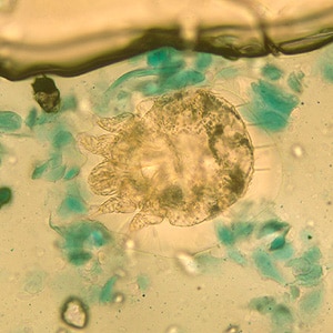 Figure A: <em>Sarcoptes scabiei</em> mite in a skin scraping, stained with lactophenol cotton-blue.