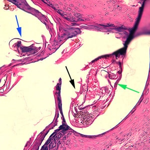 Figure B: <em>Sarcoptes scabiei</em> mites in a skin biopsy, stained with H&E. In this figure, both an adult (green arrow) and an egg (blue arrow) can be observed. Note also the presence of cuticular spines (black arrow) on the adult.