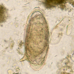Figure F: Egg of <em>S. mansoni</em> in an unstained wet mount.