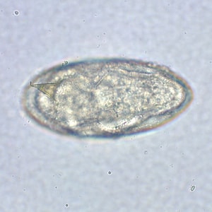 Figure D: Egg of <em>S. mansoni</em> in an unstained wet mount. Images courtesy of the Missouri State Public Health Laboratory.