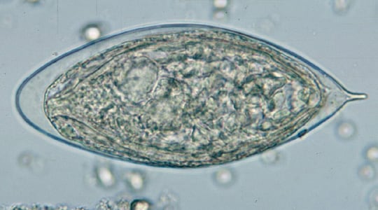 Figure B: Egg of <em>S. haematobium</em> in a wet mount of urine concentrates, showing the characteristic terminal spine.