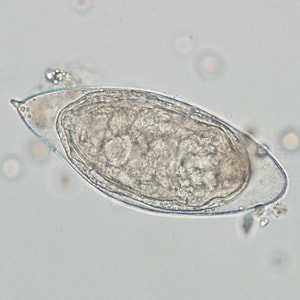 Figure C:Egg of <em>S. haematobium</em> in a wet mount of a urine concentrate.