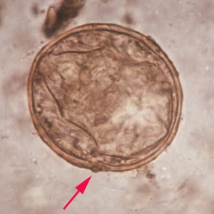 Figure A: Egg of <em>S. japonicum</em> in an unstained wet mount. Note the small, inconspicuous spines (red arrows).