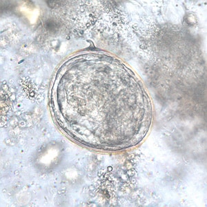 Figure F: Egg of <em>S. japonicum</em> in an unstained wet mount of stool.