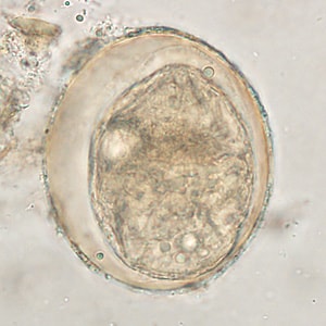 Figure D: Egg of <em>S. japonicum</em> in an unstained wet mount of stool. The spine is not visible in either of these specimens.