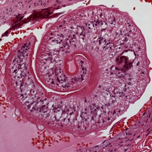 Figure B: Higher magnification of one of the worms in Figure A, showing the tuberculate exterior of the adult worm.