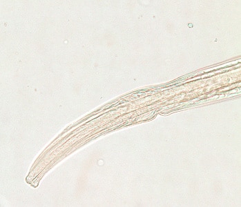Figure A: Anterior end of a female <em>Trichostrongylus</em> sp. Image of a glycerin-mounted specimen, taken at 200x magnification.