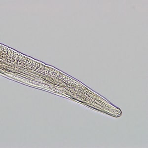 Figure C: Higher magnification of the anterior end of the specimen in Figure B.
