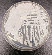 A strain of C. auris cultured in a petri dish at CDC. Photo Credit: Shawn Lockhart, CDC