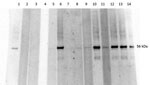 Thumbnail of Western blot analysis, using Orientia 56Kpr recombinant protein, of serum samples from febrile children in western Kenya, November 2011–December 2012. Lane 1, positive control; lane 2, negative control; lanes 3–4, Coxiella burnetii–positive patients; lane 5, Orientia spp.–negative patient; lanes 6–14, Orientia spp.–positive patients.